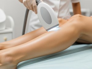 ¿Cuántas sesiones de láser diodo necesito para una depilación definitiva?